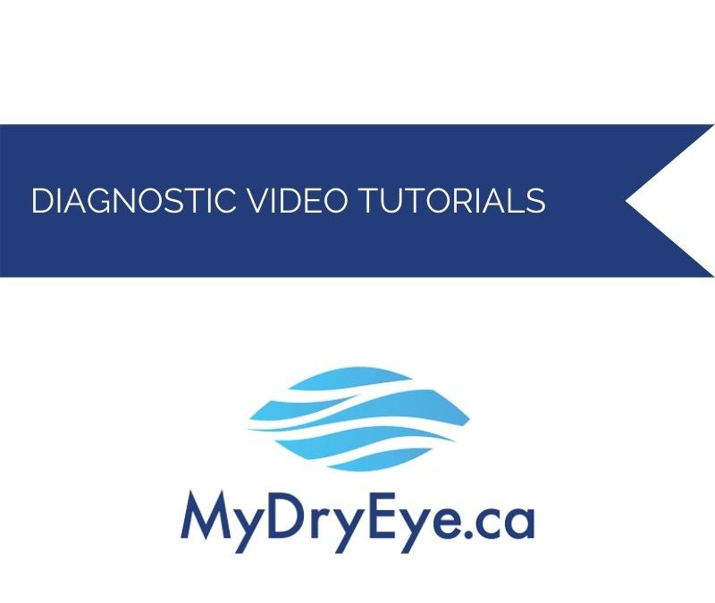 Dry Eye Procedures – Diagnostic Videos (7)