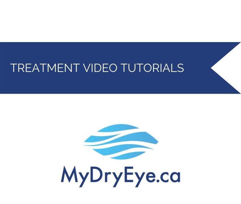 Dry Eye Procedures – Treatment Videos (2)